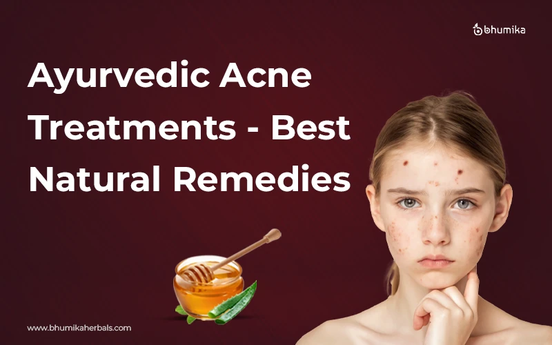 ayurvedic acne treatments