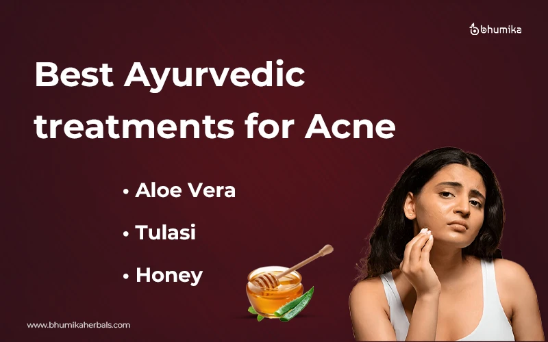 ayurvedic acne treatments for natural remedies