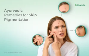 ayurvedic remedies for pigmentation