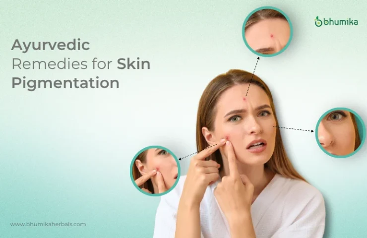 ayurvedic remedies for pigmentation