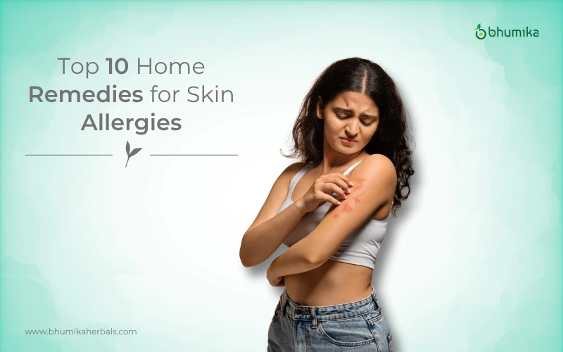 home remedies for skin allergies