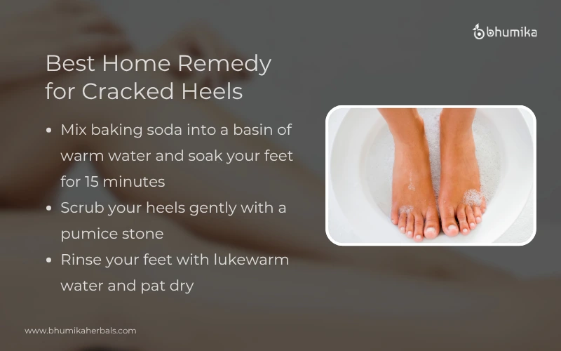 home remedy for cracked heels