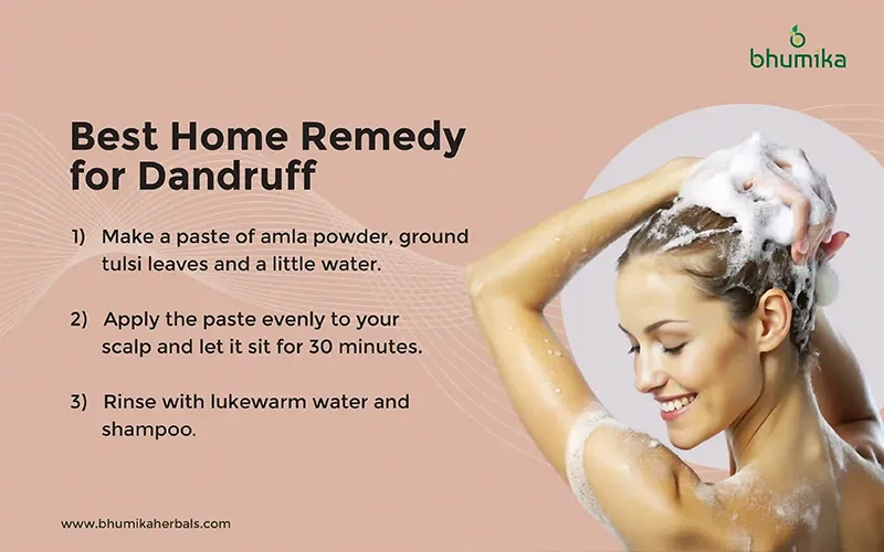 best home remedy for dandruff