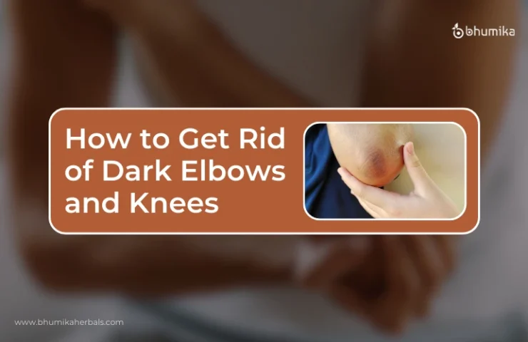 how-to-get-rid-of-dark-elbows