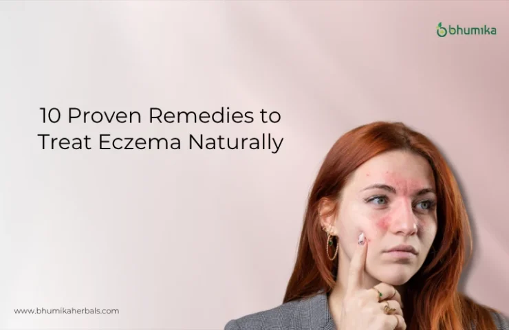 how-to-treat-eczema-naturally