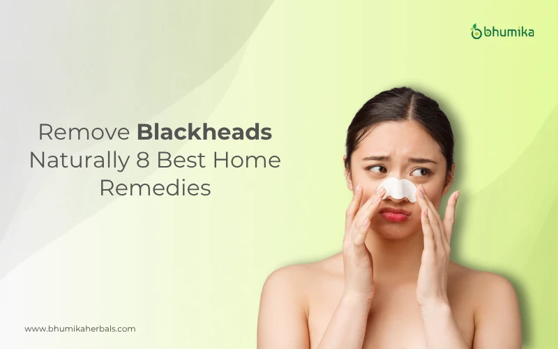 how to remove blackheads naturally
