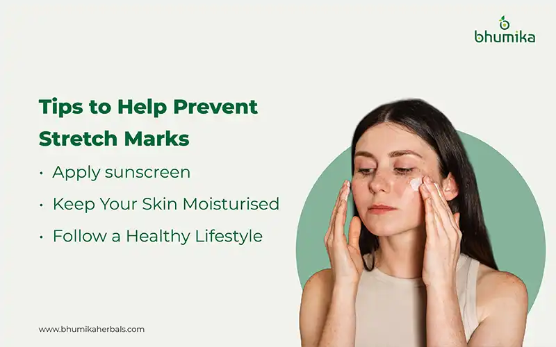 tips to prevent stretch marks