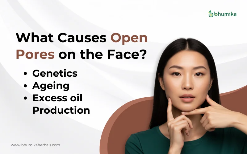 what causes open pores on face