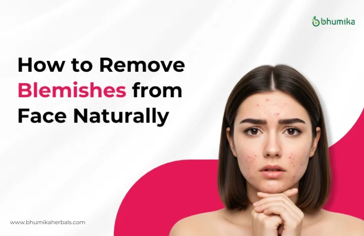 how-to-remove-blemishes-from-face