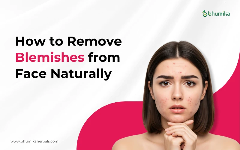 how to remove blemishes from face naturally