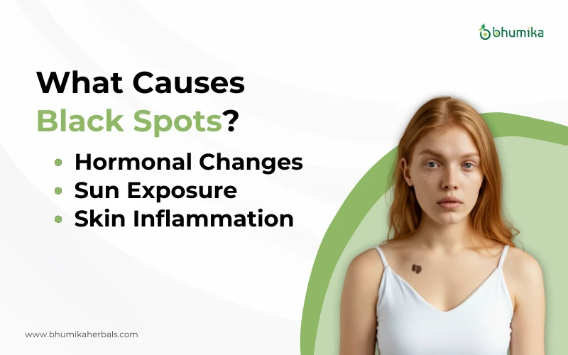 what causes black spot on face