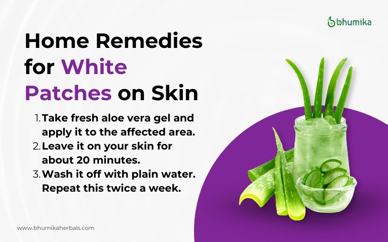 home remedies for white patches