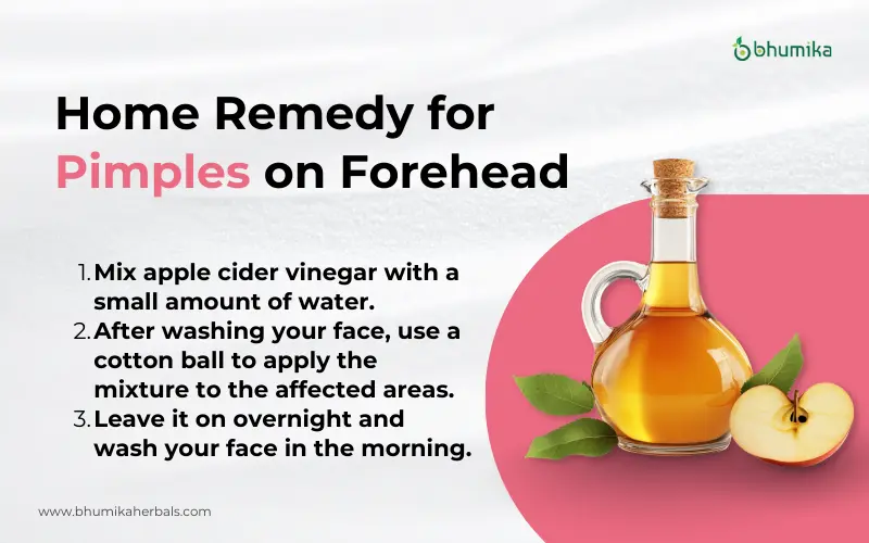 Home Remedies for Pimples on Forehead