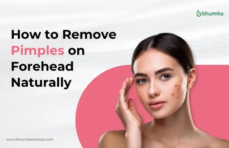 how-to-remove-plmples-on-forehead