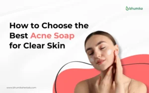 Soap for Pimples