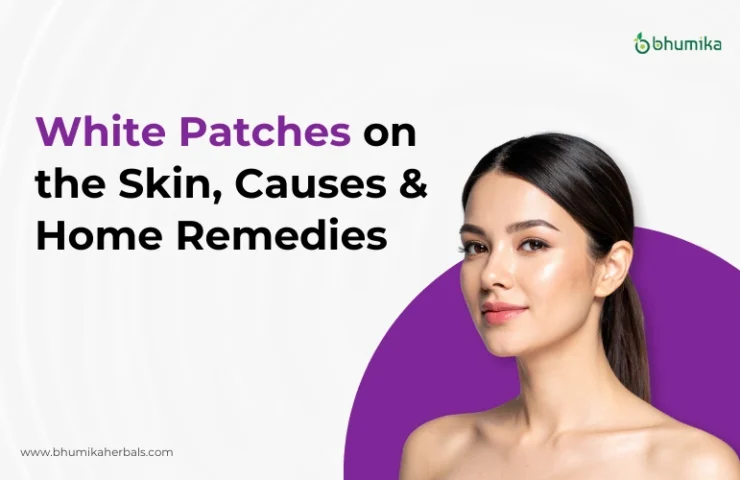 white-patches-on-skin