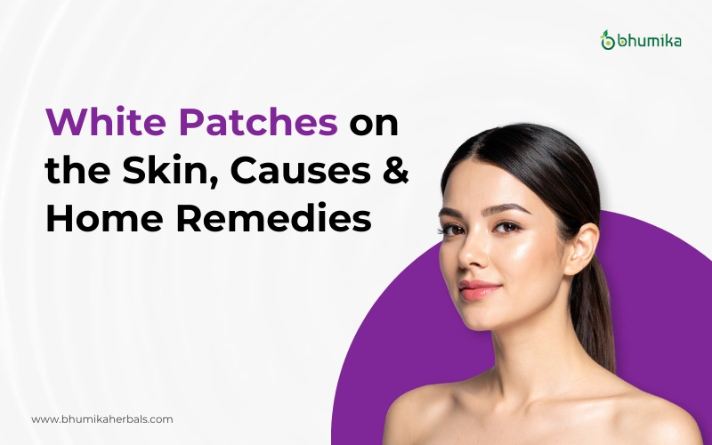 white patches on the skin